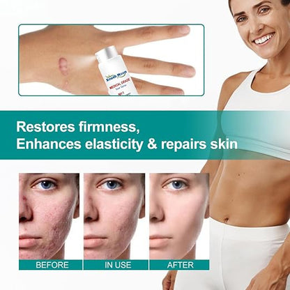 South Moon Scar Repair Spray – Advanced Skin Renewal & Scar Care Formula