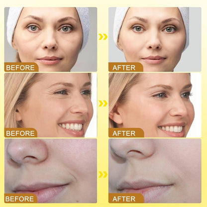 Botox Bee Venom Wrinkle Cream 20g – Anti Aging Face Cream